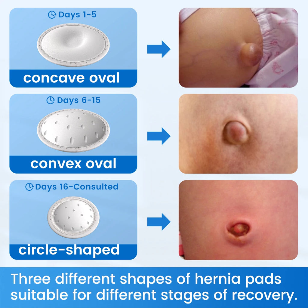 VELPEAU Baby Belly Hernia Belt with 3 Compression Pads, Umbilical Hernia Band Belly Button Abdominal Binder for Infant Newborn
