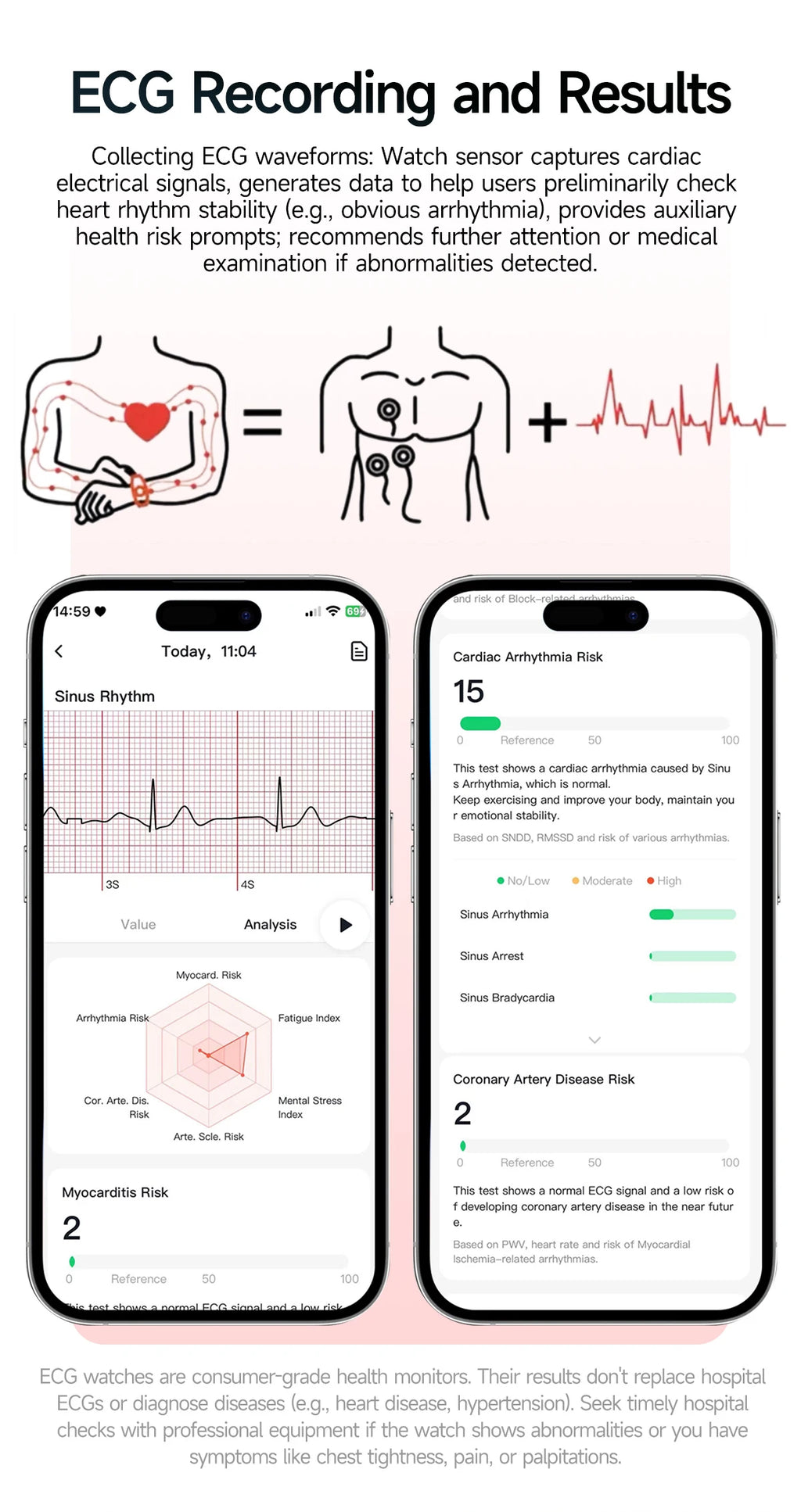 New Precise Health Care Smart Watch ECG+HRV Uric Acid Blood Lipids Emotional Perception Bluetooth Call Smartwatchs For Men Women
