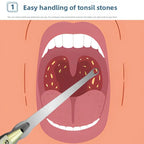 1PC Professional LED Light Tonsil Stone Remover Tool Stainless Steel Cleaner for Oral Care and Ear Wax Removal