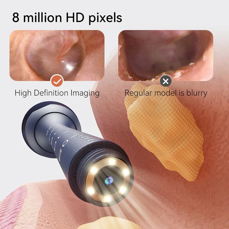 Upgraded Smart Visual Ear Wax Cleaner With Camera 800W HD Endoscope Multi-Functional Visual Ear Cleaning Tool Includes Storage