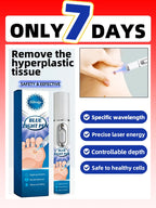2026NEW blue light pen solve warts, hot sale wart care tools