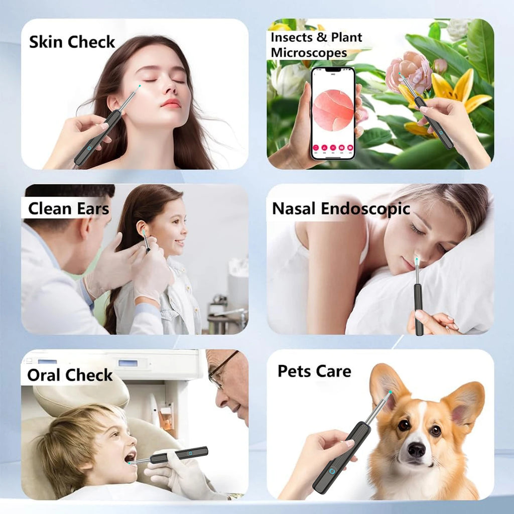 Smart Visual Ear Cleaner HD Ear Sticks Otoscope USB C Charging Endoscope Wax Removal Tool Earpick MIni Camera Health Care Set