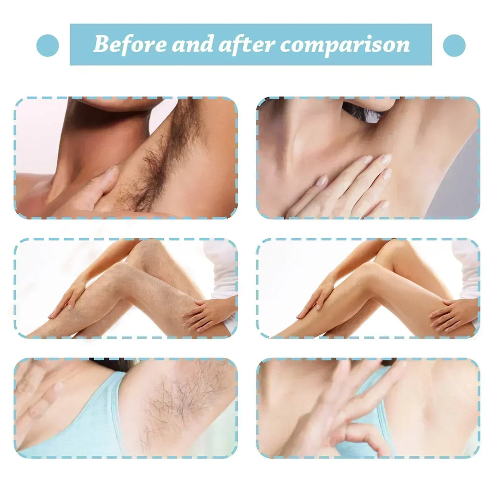 Permanent Hair Removal Spray Dissolves Hair Instantly Sprays On Effortlessly Gentle on Skin Pain-Free Long-Lasting Results