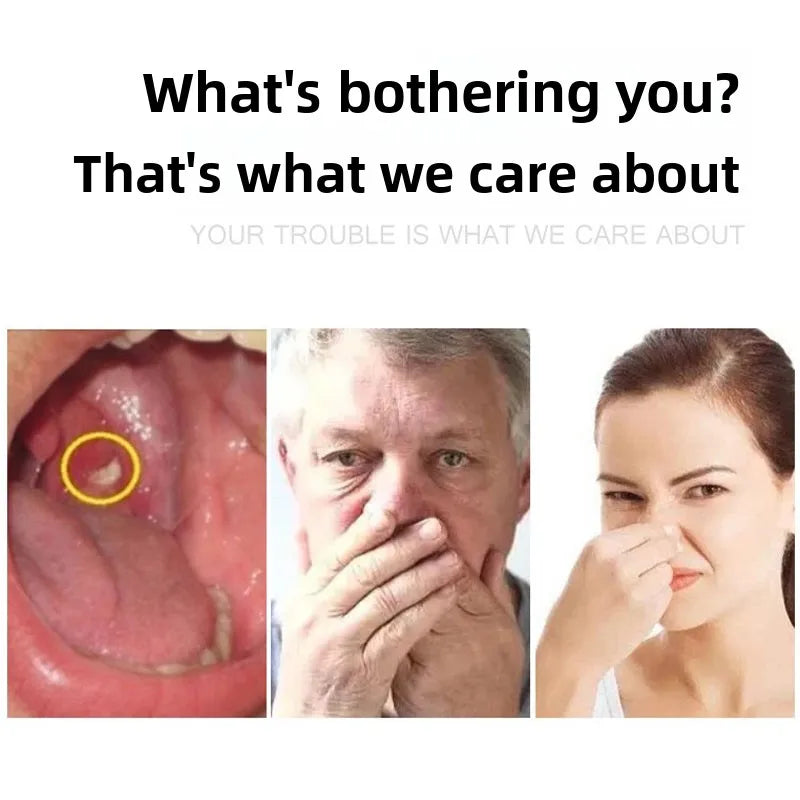 1PC Professional LED Light Tonsil Stone Remover Tool Stainless Steel Cleaner for Oral Care and Ear Wax Removal Secondary image